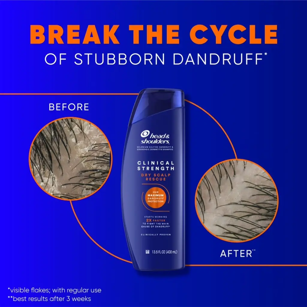 Head & Shoulders Dry Scalp Rescue Dandruff Shampoo Tw.webp